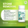 Stone Removal 